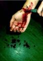 mutilation